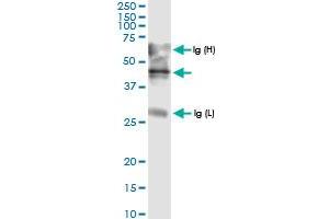Immunoprecipitation of ADAMTS4 transfected lysate using anti-ADAMTS4 MaxPab rabbit polyclonal antibody and Protein A Magnetic Bead , and immunoblotted with ADAMTS4 MaxPab rabbit polyclonal antibody (D01) .