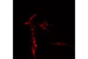 ABIN6276893 staining  COLO205 cells by IF/ICC.