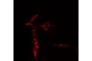 ABIN6276893 staining  COLO205 cells by IF/ICC. (Syndecan 2 anticorps  (C-Term))
