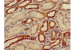 Immunohistochemistry of paraffin-embedded human kidney tissue using ABIN7149198 at dilution of 1:100 (CYP11B2 anticorps  (AA 25-503))