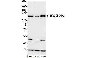 anti-DNA Repair Protein Complementing XP-G Cells (ERCC5) (AA 650-700) antibody
