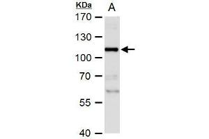 WB Image NBS1 antibody detects NBS1 protein by western blot analysis. (Nibrin anticorps)