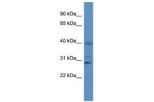 Western Blot showing CTSS antibody used at a concentration of 1 ug/ml against Jurkat Cell Lysate (Cathepsin S anticorps  (N-Term))