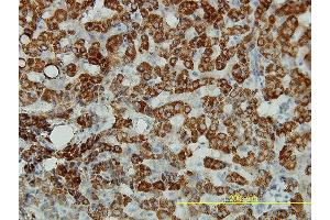 Immunoperoxidase of monoclonal antibody to ALDH4A1 on formalin-fixed paraffin-embedded human liver tissue.