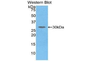 Western Blotting (WB) image for anti-serpin Peptidase Inhibitor, Clade D (Heparin Cofactor), Member 1 (SERPIND1) (AA 276-499) antibody (ABIN1859128) (SERPIND1 anticorps  (AA 276-499))