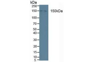 Figure. (Phospholipase C beta 3, Phosphoinositide Specific (AA 318-468) anticorps)