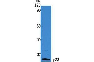 Western Blot (WB) analysis of specific cells using p23 Polyclonal Antibody.
