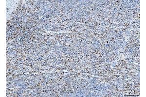 IHC analysis of FHL2 using anti-FHL2 antibody (ABIN7600782). (FHL2 anticorps  (AA 234-279))