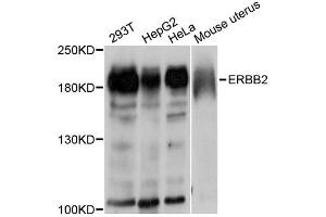 Western blot analysis of extracts of various cell lines, using ErbB2 antibody. (ErbB2/Her2 anticorps  (C-Term))