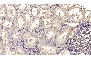 Detection of IL18 in Human Kidney Tissue using Monoclonal Antibody to Interleukin 18 (IL18)
