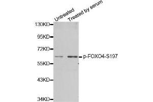 Western blot analysis of extracts from 293 cells using phospho-FOXO4-S197 antibody (ABIN2987524). (FOXO4 anticorps  (pSer197))