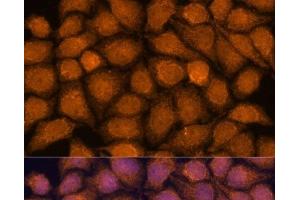 Immunofluorescence analysis of HeLa cells using TNFAIP8L2 Polyclonal Antibody at dilution of 1:100. (TNFAIP8L2 anticorps)