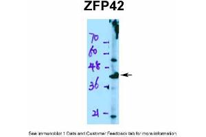 WB Suggested Anti-ZFP42 Antibody Titration:  0.