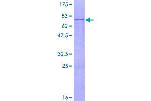Image no. 1 for Nudix (Nucleoside Diphosphate Linked Moiety X)-Type Motif 9 (NUDT9) (AA 1-350) protein (GST tag) (ABIN1313202)