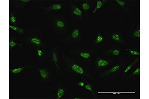 Immunofluorescence of purified MaxPab antibody to DUSP4 on HeLa cell.