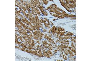 Immunohistochemistry of paraffin-embedded mouse heart using FKBP1B antibody (ABIN7267212) at dilution of 1:100 (40x lens).