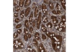 Immunohistochemical staining of human duodenum with TANC2 polyclonal antibody  strong cytoplasmic positivity in glandular cells. (TANC2 anticorps)