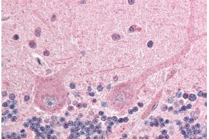 Human Brain, Cerebellum (formalin-fixed, paraffin-embedded) stained with ING4 antibody ABIN292976 at 2. (ING4 anticorps  (AA 164-175))
