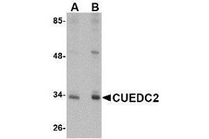 Western blot analysis of CUEDC2 in HeLa cell lysate with AP30262PU-N CUEDC2 antibody at (A) 1 and (B) 2 μg/ml.