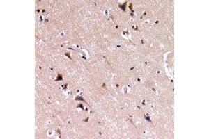 Immunohistochemical analysis of Nephrin staining in human brain formalin fixed paraffin embedded tissue section. (Nephrin anticorps  (C-Term))