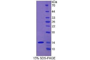 SDS-PAGE (SDS) image for Alanine Aminotransferase (ALT) (AA 367-480) protein (His tag) (ABIN1078753)