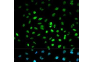 Immunofluorescence analysis of MCF-7 cells using LKB1 Polyclonal Antibody (LKB1 anticorps)