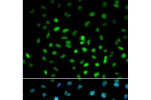 Immunofluorescence analysis of MCF-7 cells using LKB1 Polyclonal Antibody