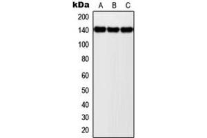 Western blot analysis of NOLC1 expression in MCF7 (A), SP2/0 (B), PC12 (C) whole cell lysates. (NOLC1 anticorps  (C-Term))