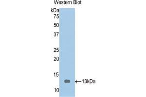 Western blot analysis of the recombinant protein. (Tropomodulin 1 anticorps  (AA 39-138))