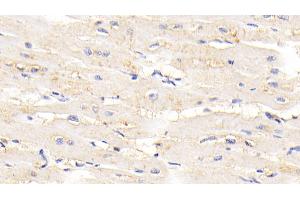 Detection of TTN in Human Cardiac Muscle Tissue using Polyclonal Antibody to Titin (TTN) (Titin anticorps  (AA 33779-34025))