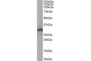 Western Blotting (WB) image for anti-Four and A Half LIM Domains 1 (FHL1) (Internal Region) antibody (ABIN2465696) (FHL1 anticorps  (Internal Region))