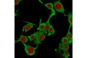 Immunofluorescence Analysis of PFA-fixed HePG2 cells labeling TNFalpha with TNF alpha Mouse Monoclonal Antibody (TNFA/1172) followed by Goat anti-Mouse IgG-CF488 (Green).
