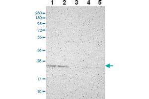 Western blot analysis of Lane 1: RT-4 Lane 2: U-251 MG Lane 3: Human Plasma Lane 4: Liver Lane 5: Tonsil with PDDC1 polyclonal antibody ( Cat # PAB28008 ) at 1:100 - 1:250 dilution. (PDDC1 anticorps)