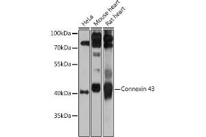 Western blot analysis of extracts of various cell lines, using Connexin 43 antibody (ABIN6131701, ABIN6141098, ABIN6141099 and ABIN6215448) at 1:1000 dilution. (Connexin 43/GJA1 anticorps  (AA 233-382))