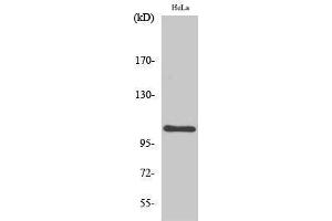 Western Blotting (WB) image for anti-Nuclear Factor of kappa Light Polypeptide Gene Enhancer in B-Cells 1 (NFKB1) (Thr147) antibody (ABIN3185879)