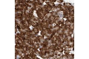 Immunohistochemical staining of human pancreas with ZNF341 polyclonal antibody  shows strong cytoplasmic positivity in exocrine cells at 1:200-1:500 dilution. (ZNF341 anticorps)