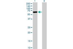 Western Blot analysis of ARMCX5 expression in transfected 293T cell line by ARMCX5 MaxPab polyclonal antibody. (ARMCX5 anticorps  (AA 1-558))