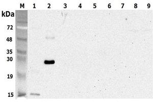 Western blot analysis using anti-CTRP5 (human), pAb  at 1:5'000 dilution. (CTRP5 anticorps)