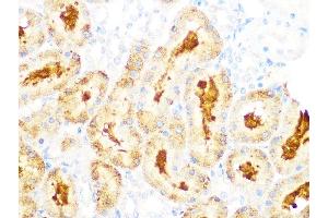 Immunohistochemistry of paraffin-embedded rat kidney using GCLC Rabbit mAb (ABIN1680604, ABIN3018993, ABIN3018994 and ABIN7101696) at dilution of 1:100 (40x lens).