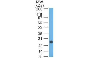 anti-IgL antibody