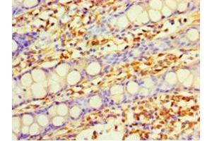 Immunohistochemistry of paraffin-embedded human colon tissue using ABIN7149619 at dilution of 1:100