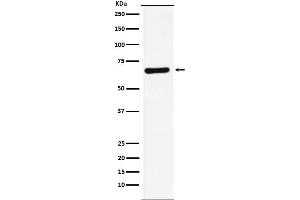 Western blot analysis of STXBP1 expression in HeLa cell lysate.