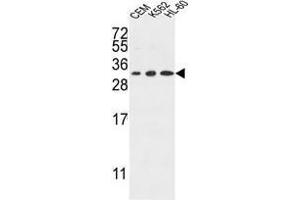 TSPAN2 Antibody (Center) western blot analysis in CEM,K562,HL-60 cell line lysates (35 µg/lane). (Tetraspanin 2 anticorps  (Middle Region))