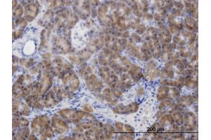 Immunoperoxidase of monoclonal antibody to CBS on formalin-fixed paraffin-embedded human pancreas. (CBS anticorps  (AA 1-100))