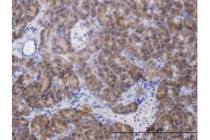 Immunoperoxidase of monoclonal antibody to CBS on formalin-fixed paraffin-embedded human pancreas.
