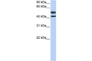 WB Suggested Anti-GNS Antibody Titration:  0. (GNS anticorps  (C-Term))