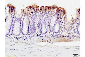 Formalin-fixed and paraffin embedded mouse intestine labeled with Anti-SUMO 1 Polyclonal Antibody, Unconjugated (ABIN687397) at 1:200 followed by conjugation to the secondary antibody and DAB staining. (SUMO1 anticorps  (AA 21-101))