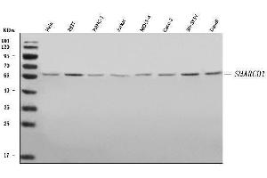Western blot analysis of SMARCD1 using anti-SMARCD1 antibody (ABIN7603235).