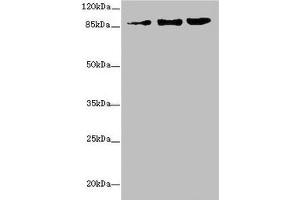 Western blot All lanes: ZNF148 antibody at 1. (ZNF148 anticorps  (AA 690-794))