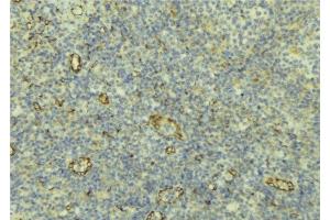 ABIN6277008 at 1/100 staining Human lymph tissue by IHC-P.